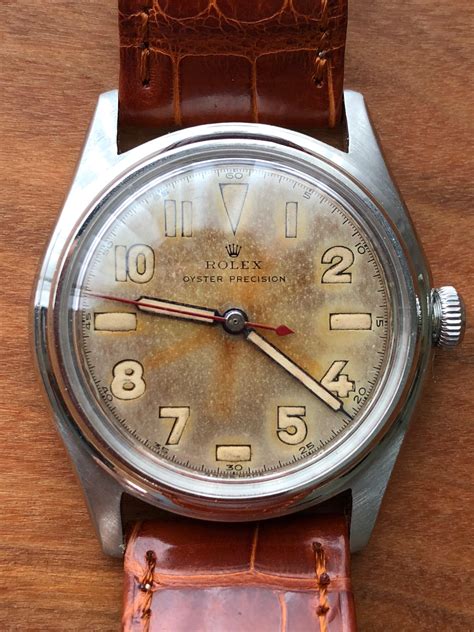 rolex watches radium